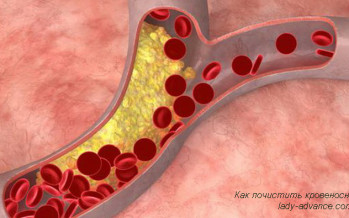 Как естественным путем почистить кровеносные сосуды и артерии