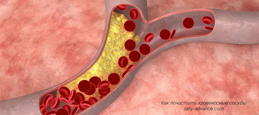 Как естественным путем почистить кровеносные сосуды и артерии
