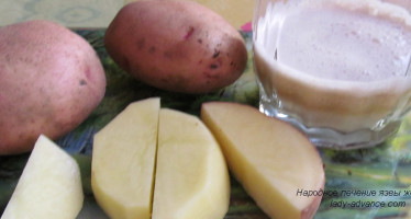 Народное лечение язвы желудка картофелем и бананом